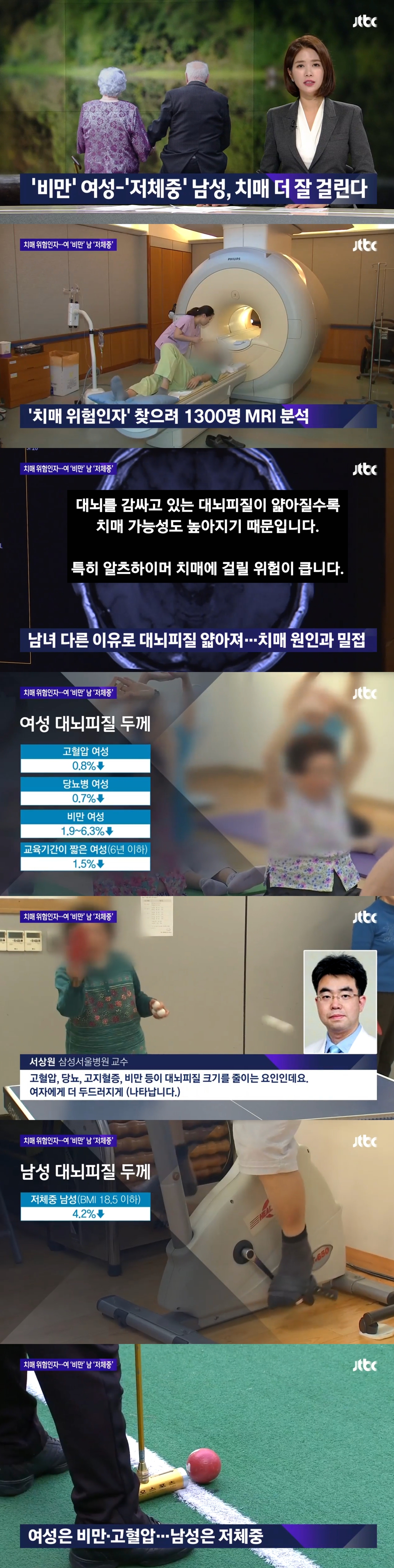  비만 여성, 저체중 남성 치매 더 잘 걸린다.jpg