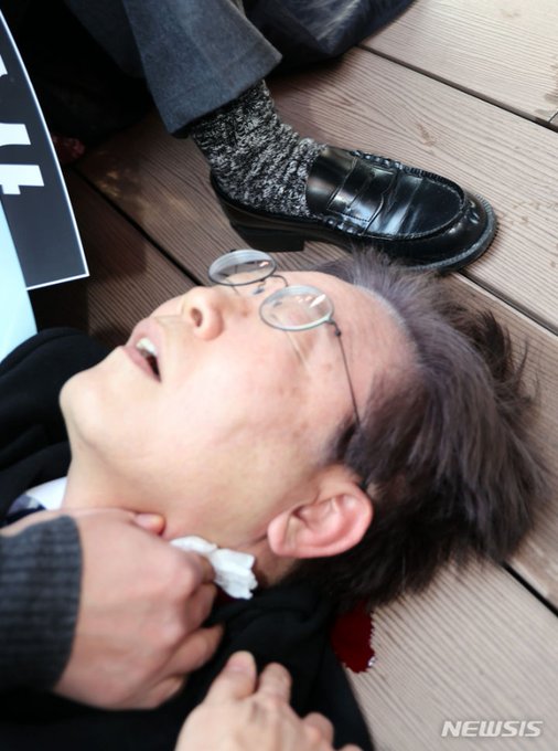 (주의) 어제 토론 보고 찾아본, 정말 죽다 살아나온 듯한 이재명 목 흉터와 피습 사진 | 인스티즈