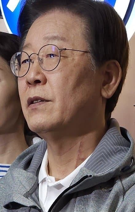  (주의) 어제 토론 보고 찾아본, 정말 죽다 살아나온 듯한 이재명 목 흉터와 피습 ..