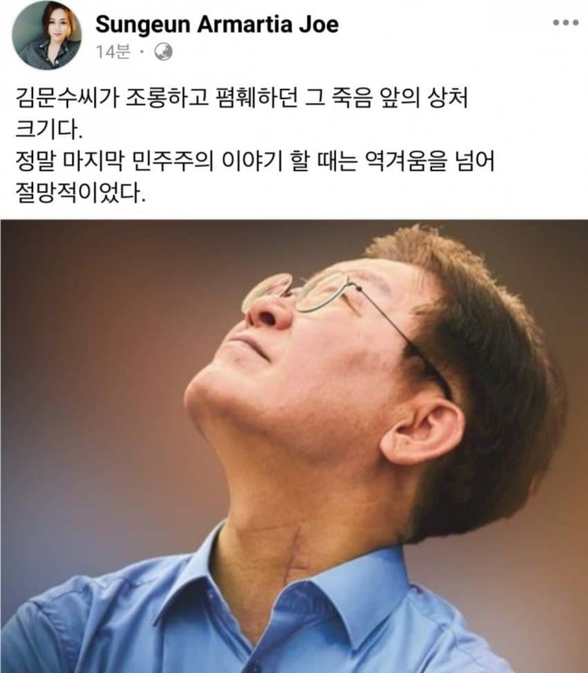 (주의) 어제 토론 보고 찾아본, 정말 죽다 살아나온 듯한 이재명 목 흉터와 피습 사진 | 인스티즈