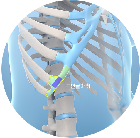 기기괴괴 그 자체인 요즘 유행한다는 코 수술 방법(혐) | 인스티즈