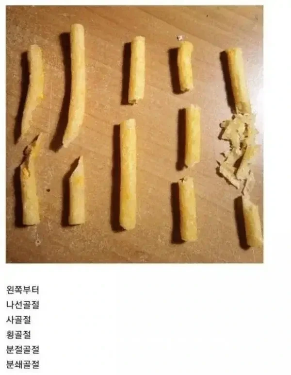  과자로 알아보는 뼈 골절
