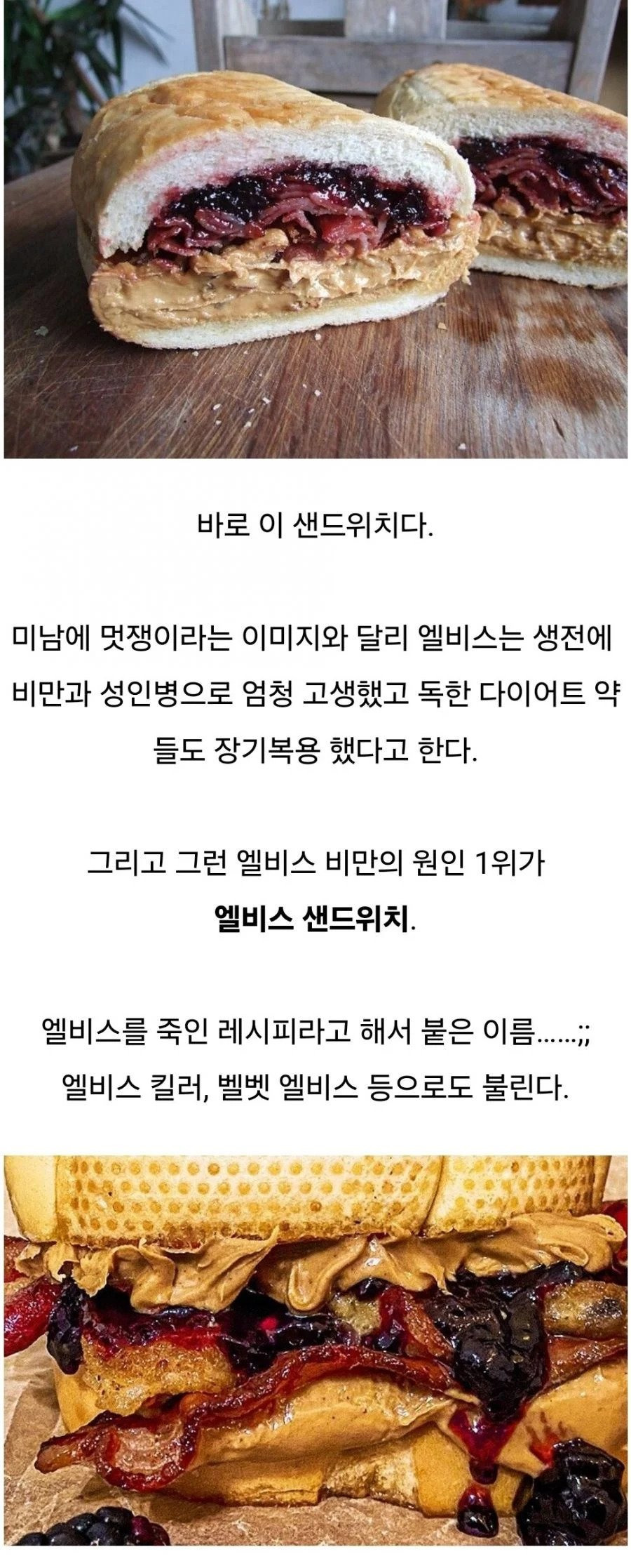 엘비스 프레슬리의 사망원인.jpg | 인스티즈