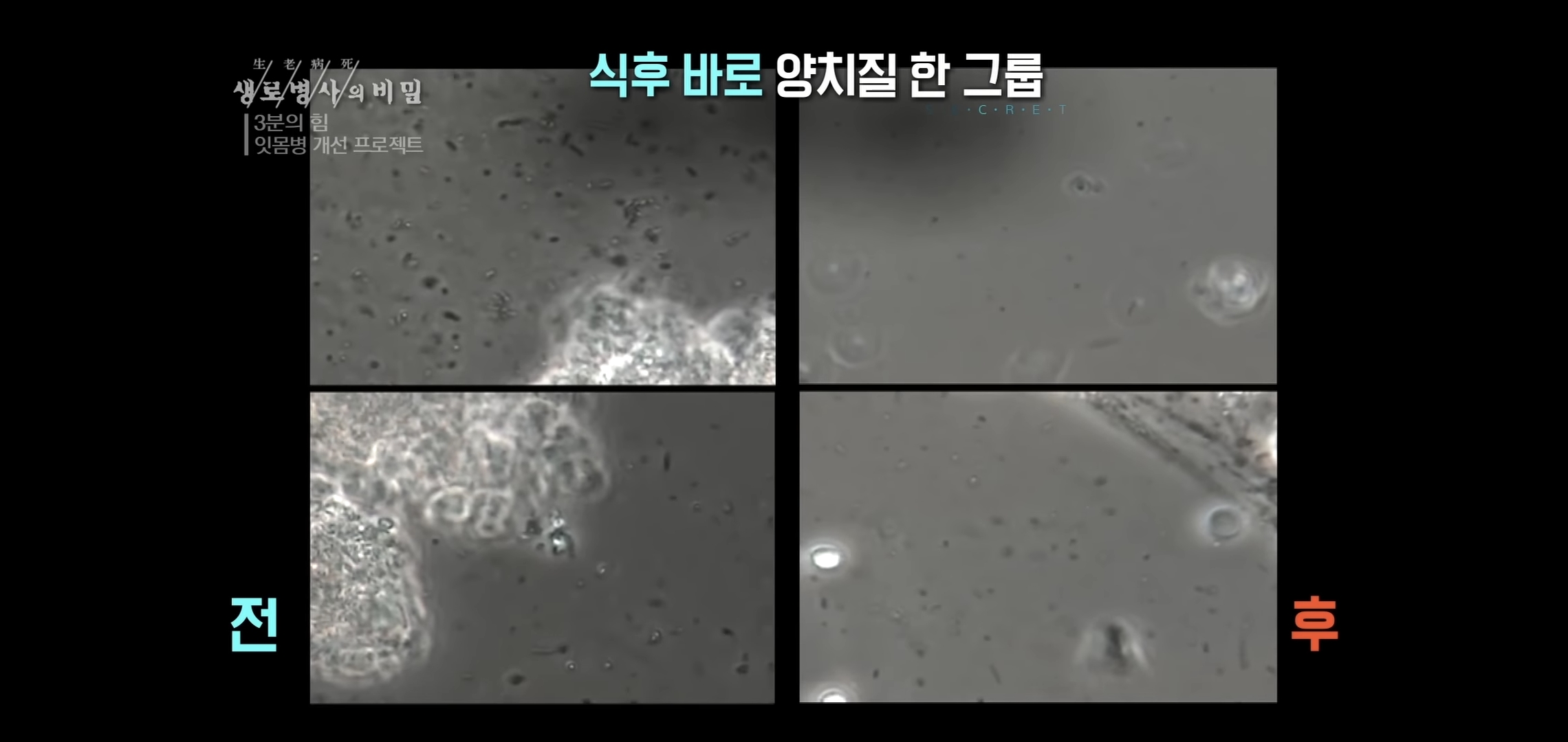 자기 직전에 양치질하는 사람들 충격적 실험 결과..jpg | 인스티즈