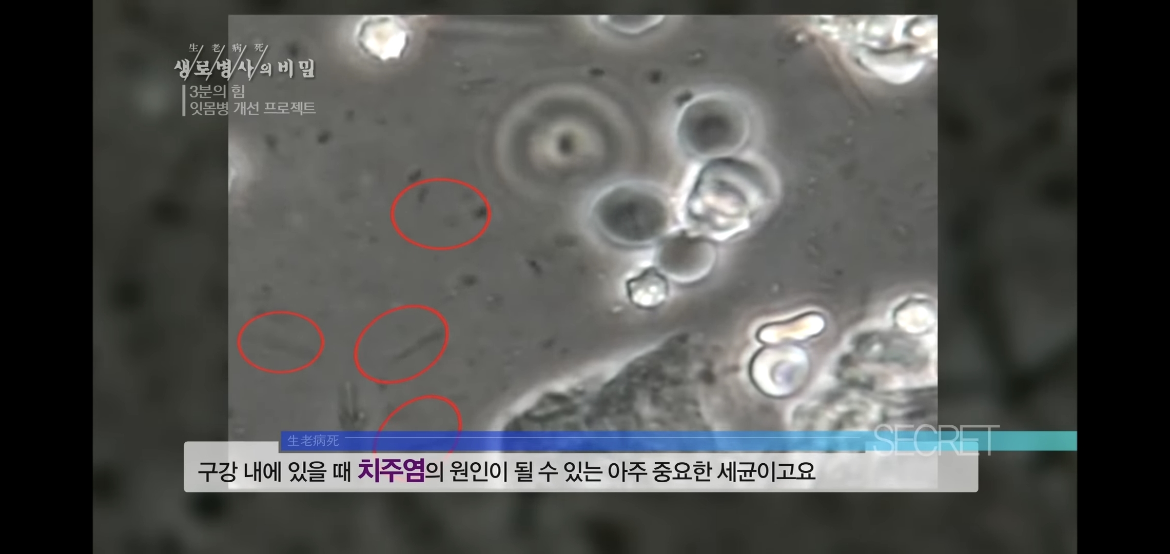 자기 직전에 양치질하는 사람들 충격적 실험 결과..jpg | 인스티즈