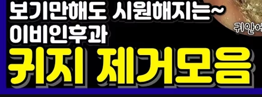  귀지 제거모음.zip1
