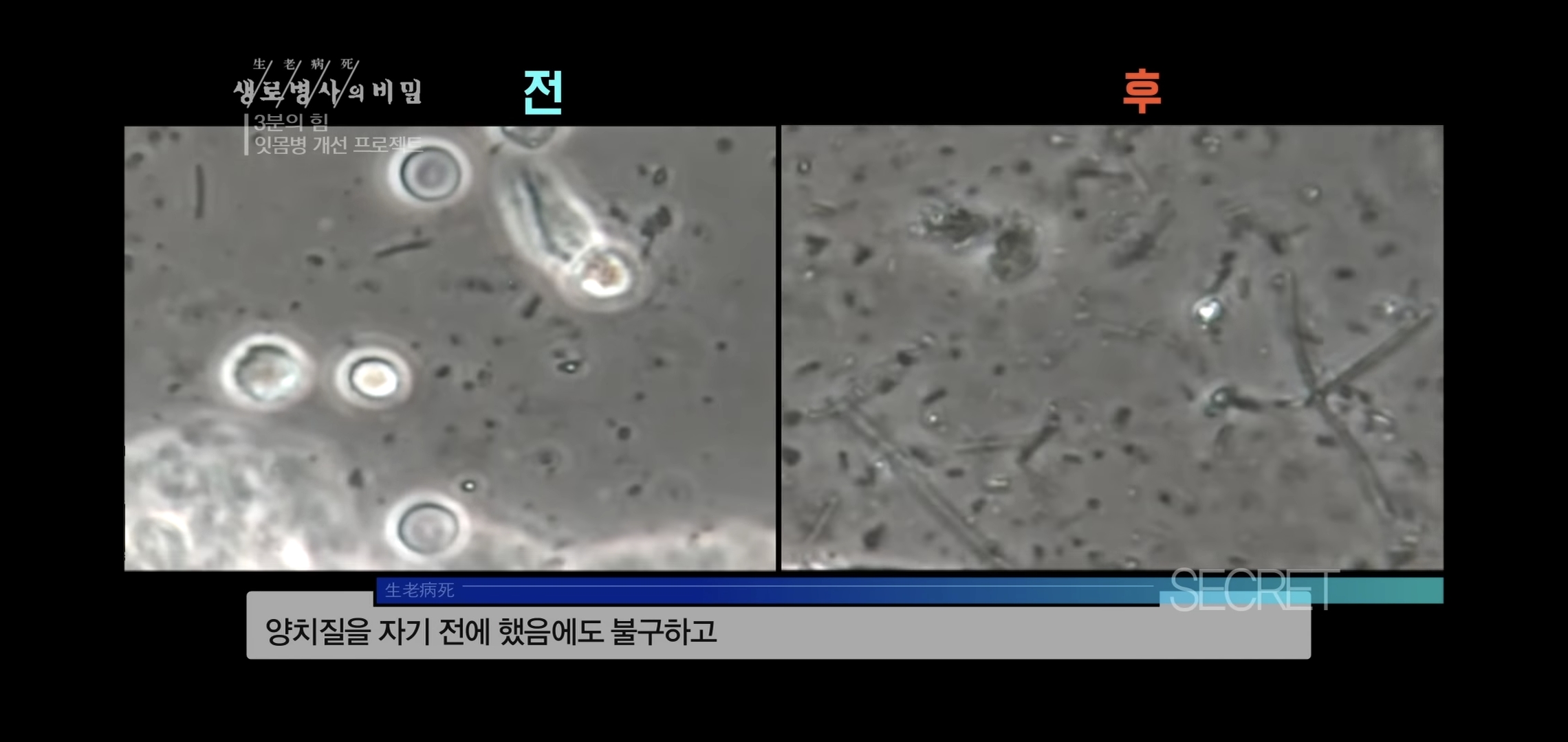 자기 직전에 양치질하는 사람들 충격적 실험 결과..jpg | 인스티즈