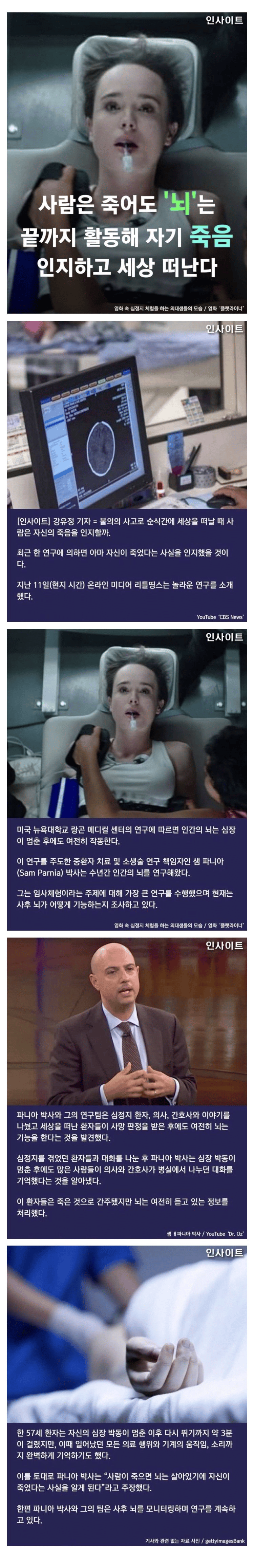  사람은 죽어도 뇌는 끝까지 활동해 자기 죽음 인지하고 세상 떠난다.jpg