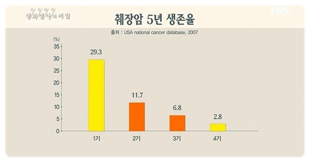 췌장암 검사 꼭 해야 하는 이유 | 인스티즈