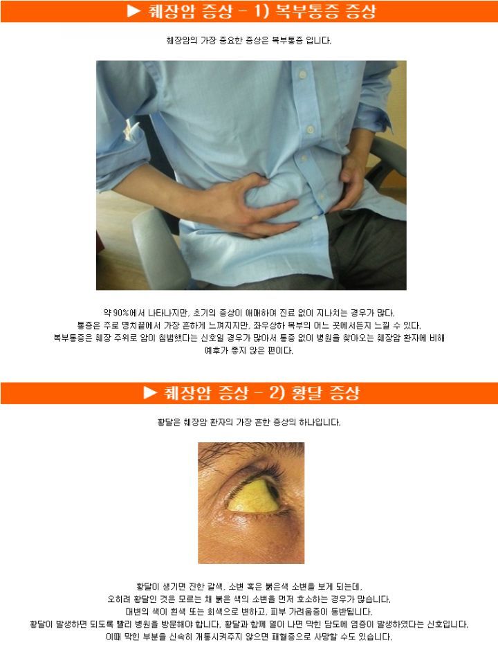 췌장암 검사 꼭 해야 하는 이유 | 인스티즈