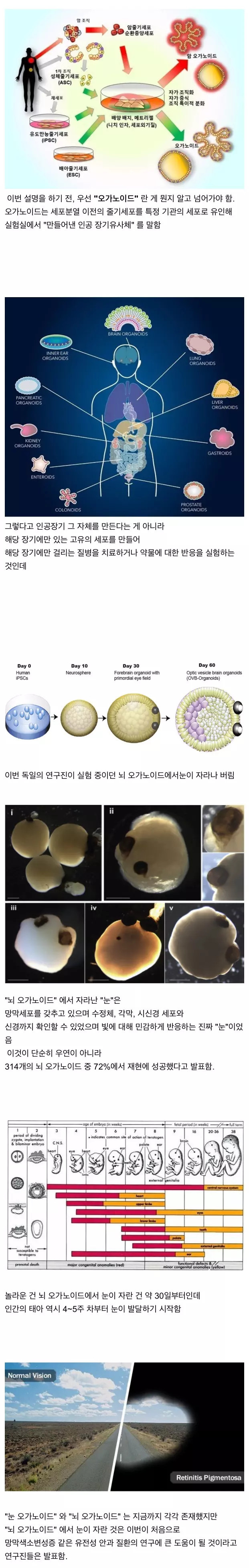  인공 뇌에서 눈 생성