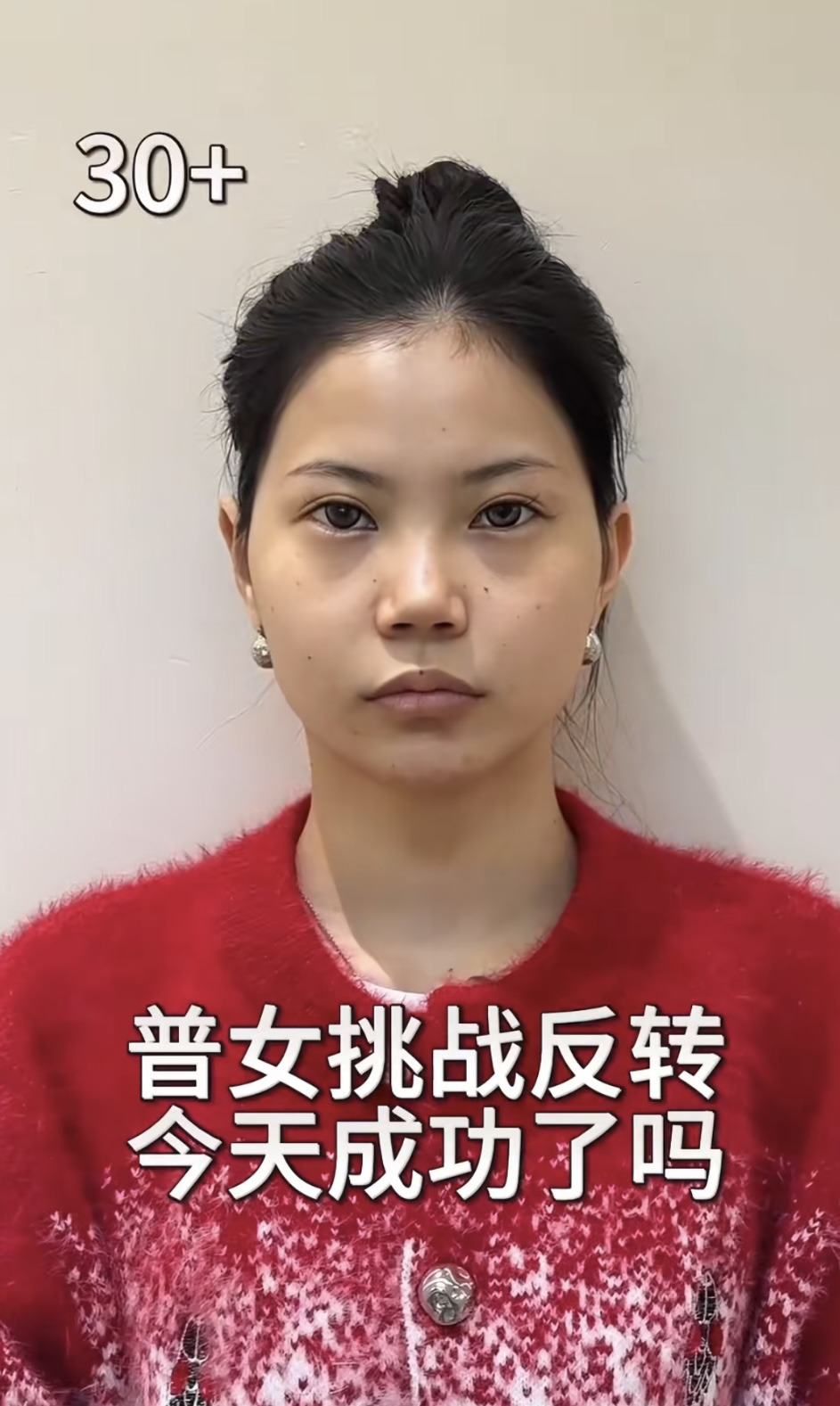 중녀 미감 만들어준다는 왕징 성형외과 다녀온 유튜버.jpg | 인스티즈