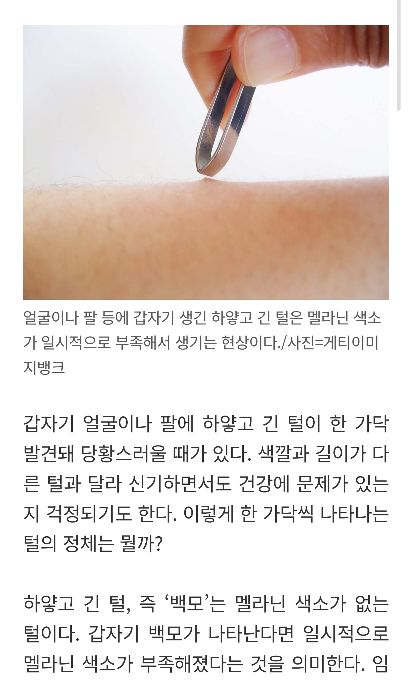 뜬금없이 피부에 자란 '길고 하얀' 털 한 가닥… 정체 뭘까? | 인스티즈