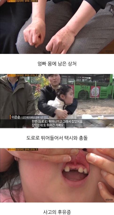 [PD수첩] 발달장애인의 엄마로 산다는 것 | 인스티즈