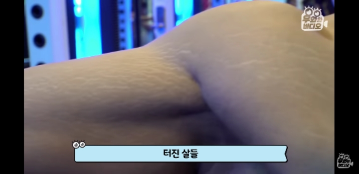 150키로 초고도비만 남자 5년만에 | 인스티즈