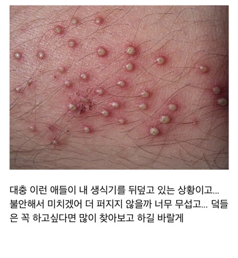 사진주의)브라질리언 왁싱 한 거 울면서 후회하는 후기.jpg | 인스티즈