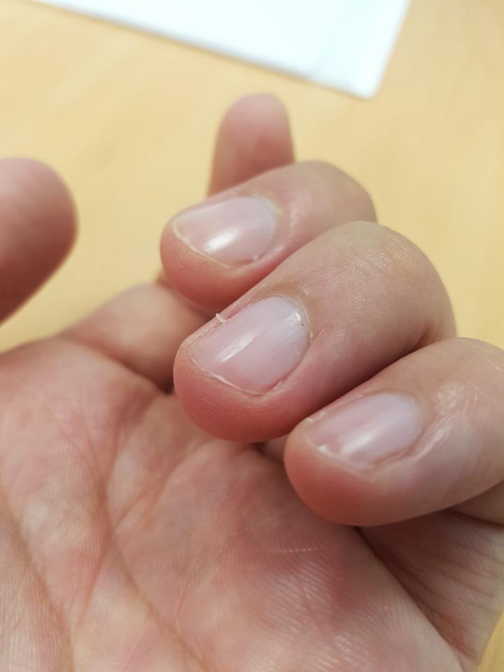 뇌손상 온게 아니라 이건 진짜 처서매직...jpg | 인스티즈