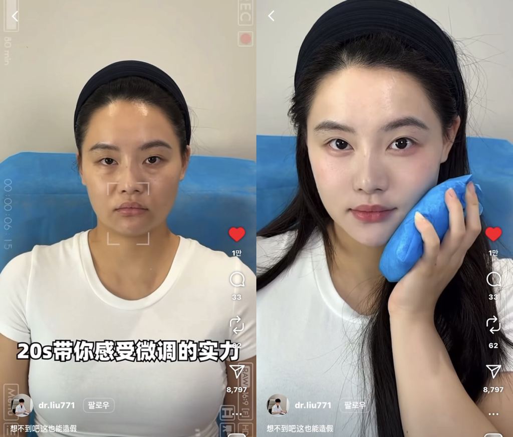 성형•시술 가짜 비포 애프터 만드는 과정.jpg | 인스티즈