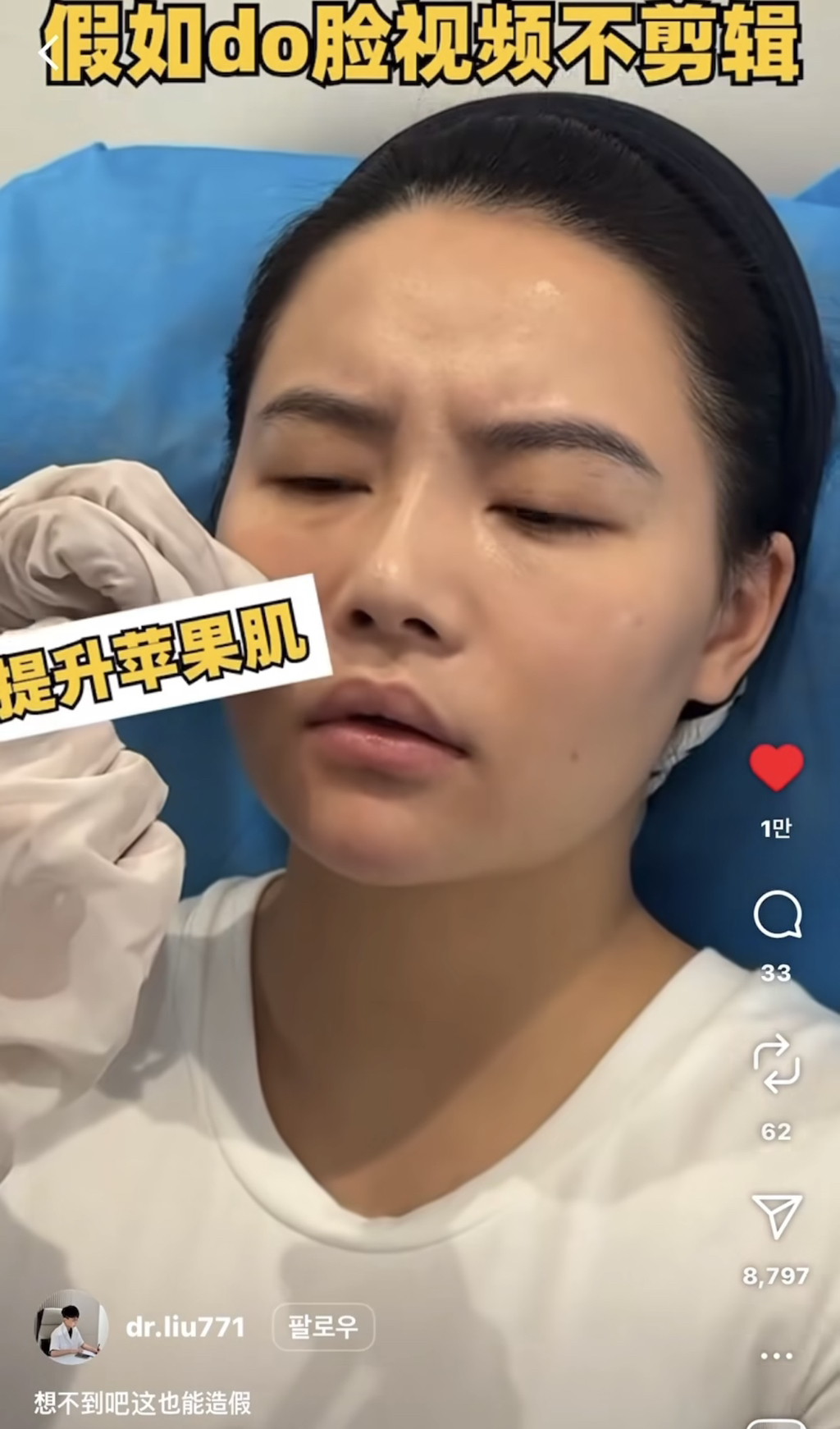 성형•시술 가짜 비포 애프터 만드는 과정.jpg | 인스티즈