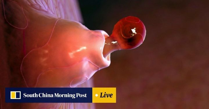 배란통이 있는 이유.jpg (사진 주의) | 인스티즈