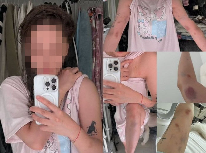 홍대서 '하룻밤' 거절한 대만 유튜버 폭행, 알고보니 중국 남성 | 인스티즈