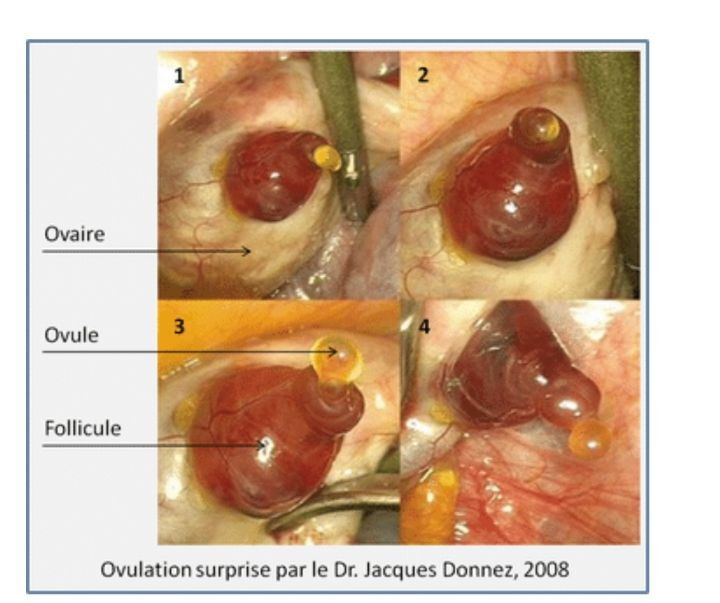 배란통이 있는 이유.jpg (사진 주의) | 인스티즈