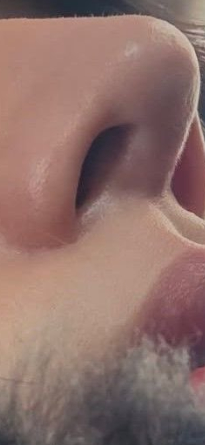 코 절개선 자국 블러처리하는 남돌 | 인스티즈