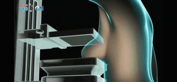 여자들이 건강검진 받을때 충격받는다는 기계.jpgif | 인스티즈