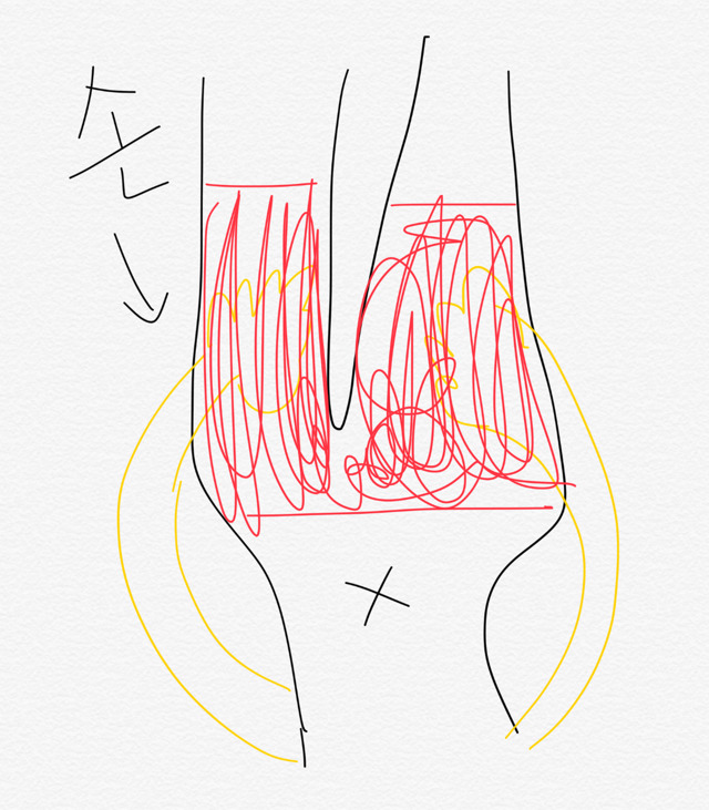 팬티속에 손넣고 자면 잠잘오는 사람 꼭 있다.jpg | 인스티즈