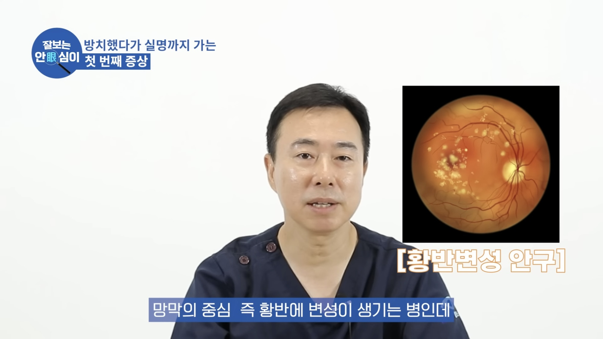 눈이 실명 전 잠깐 보내는 마지막 신호. 이 증상이 보인다면 당장 병원 뛰쳐가세요.jpg | 인스티즈