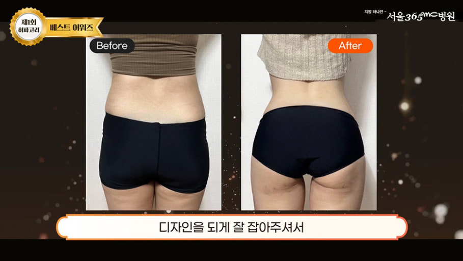 허파고리가 무슨 뜻인지 알아?? | 인스티즈