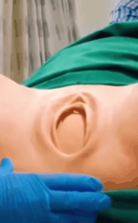 애 가질 여자라면 꼭 봐야되는 사진 (혐오주의) | 인스티즈