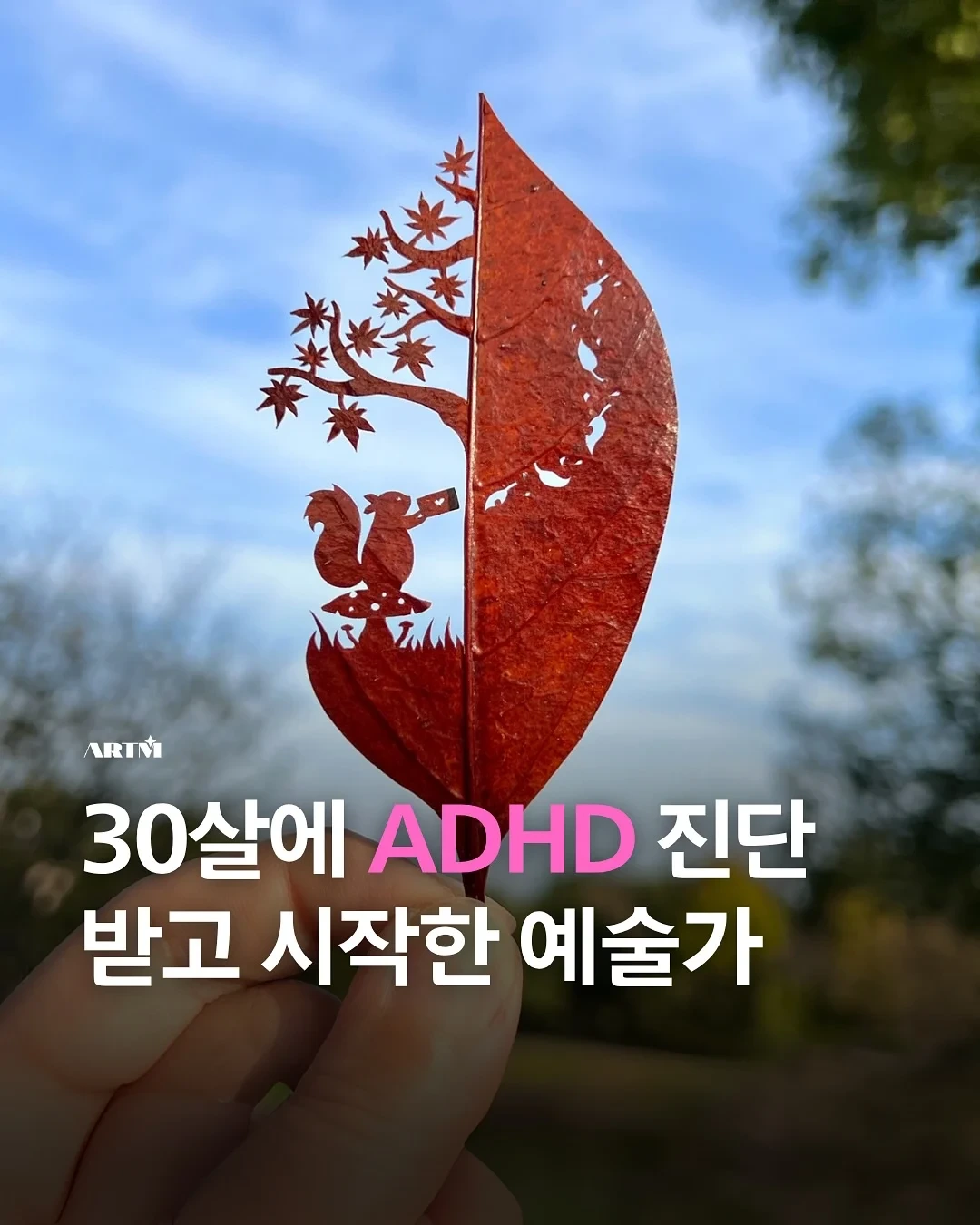 30살에 ADHD 판정 받고 시작한 예술 | 인스티즈