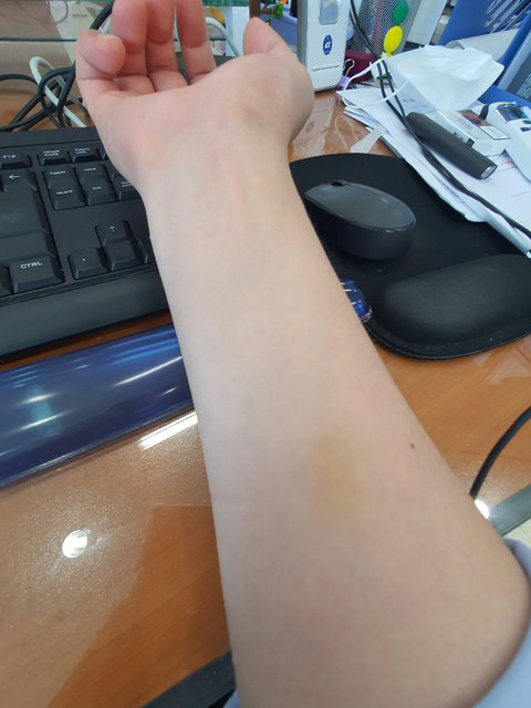 남편이 가위를 5개월 넘게 눌리고 있습니다+후기(약홍콩) | 인스티즈