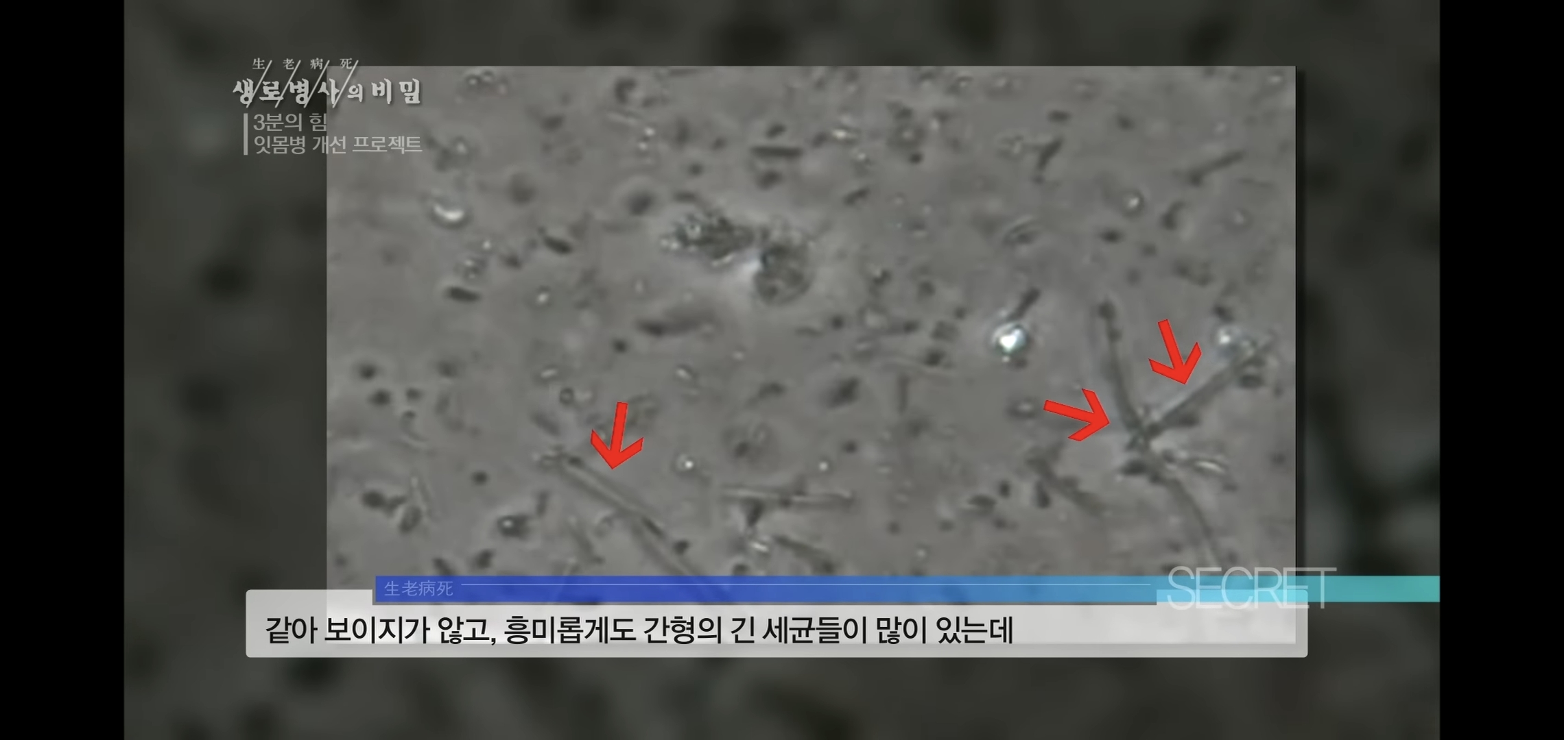 자기 직전에 양치질하는 사람들 충격적 실험 결과..jpg | 인스티즈