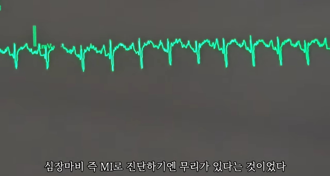 일하다가 심장마비 느낀 간호사 브이로그 | 인스티즈