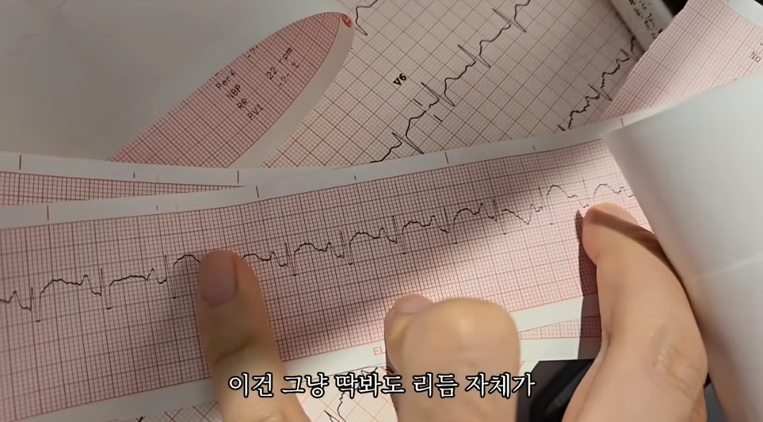 일하다가 심장마비 느낀 간호사 브이로그 | 인스티즈