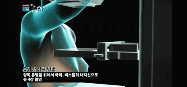 여자들이 건강검진 받을때 충격받는다는 기계.jpgif | 인스티즈