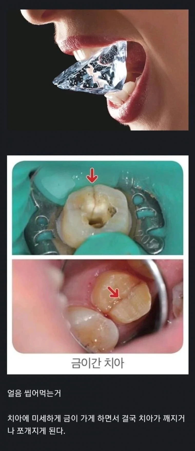 치과에서 하지말라는 거 | 인스티즈