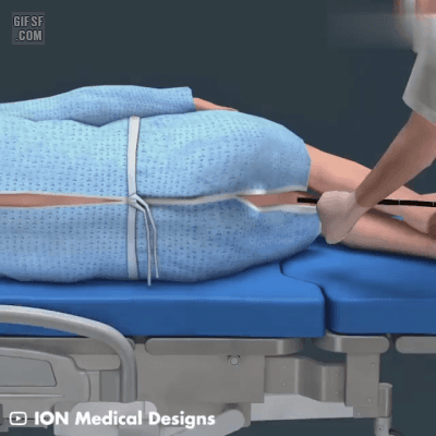 대장내시경 검사과정 | 인스티즈