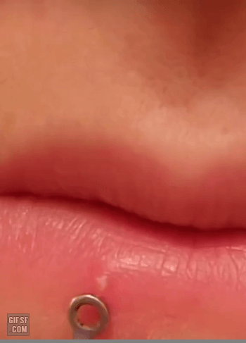 입술 뾰루지 짜기 | 인스티즈