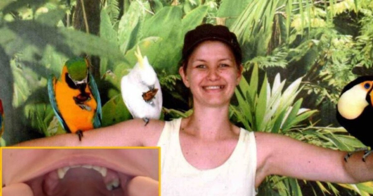 "어금니 하나만 남았다”…30대女, 수년간 '이것' 쓴 탓? | 인스티즈