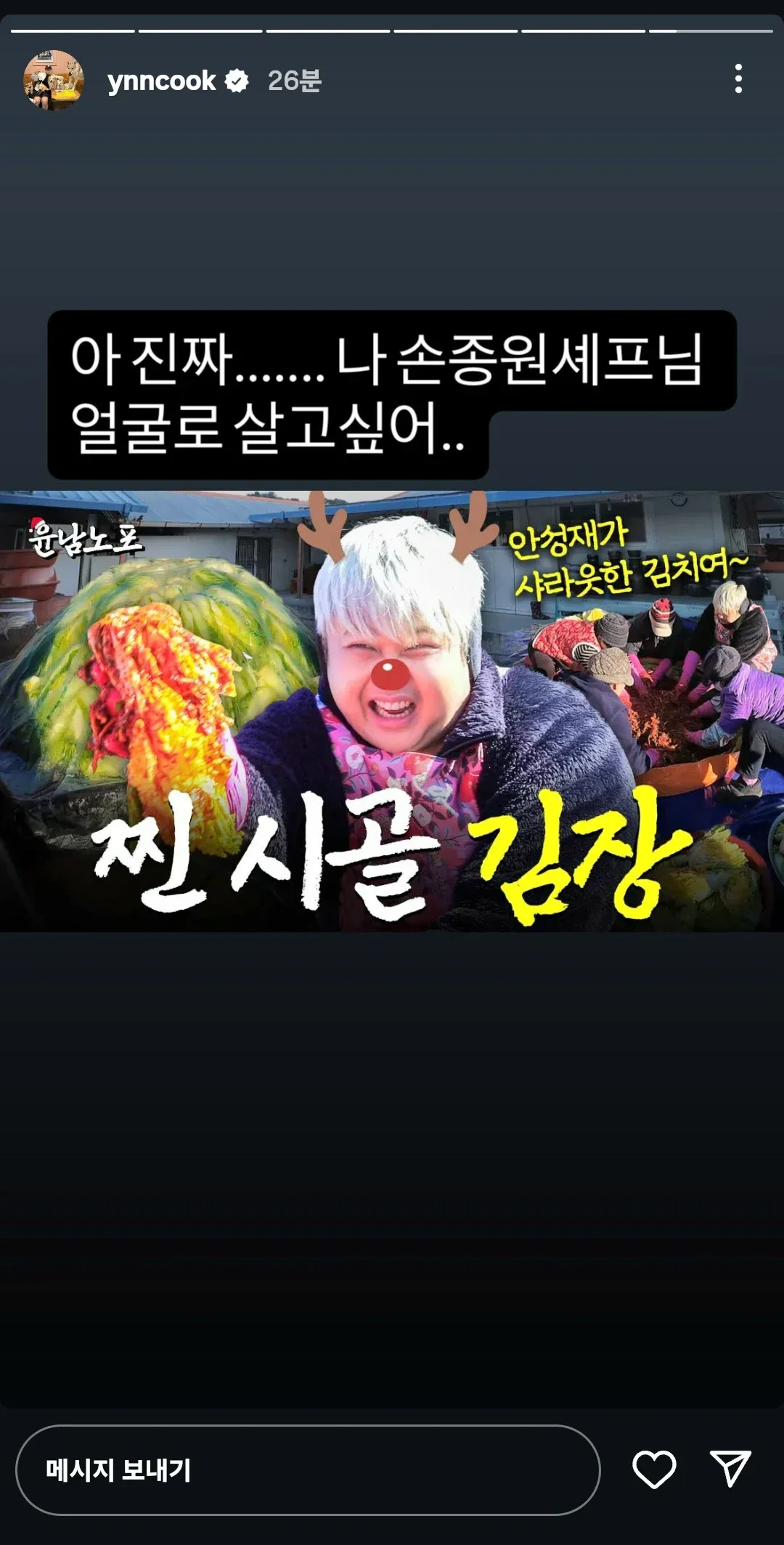 자기 얼굴이 불편하고 힘들다는 셰프 | 인스티즈