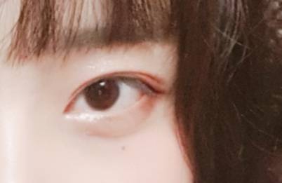 나도 눈공 40 | 인스티즈