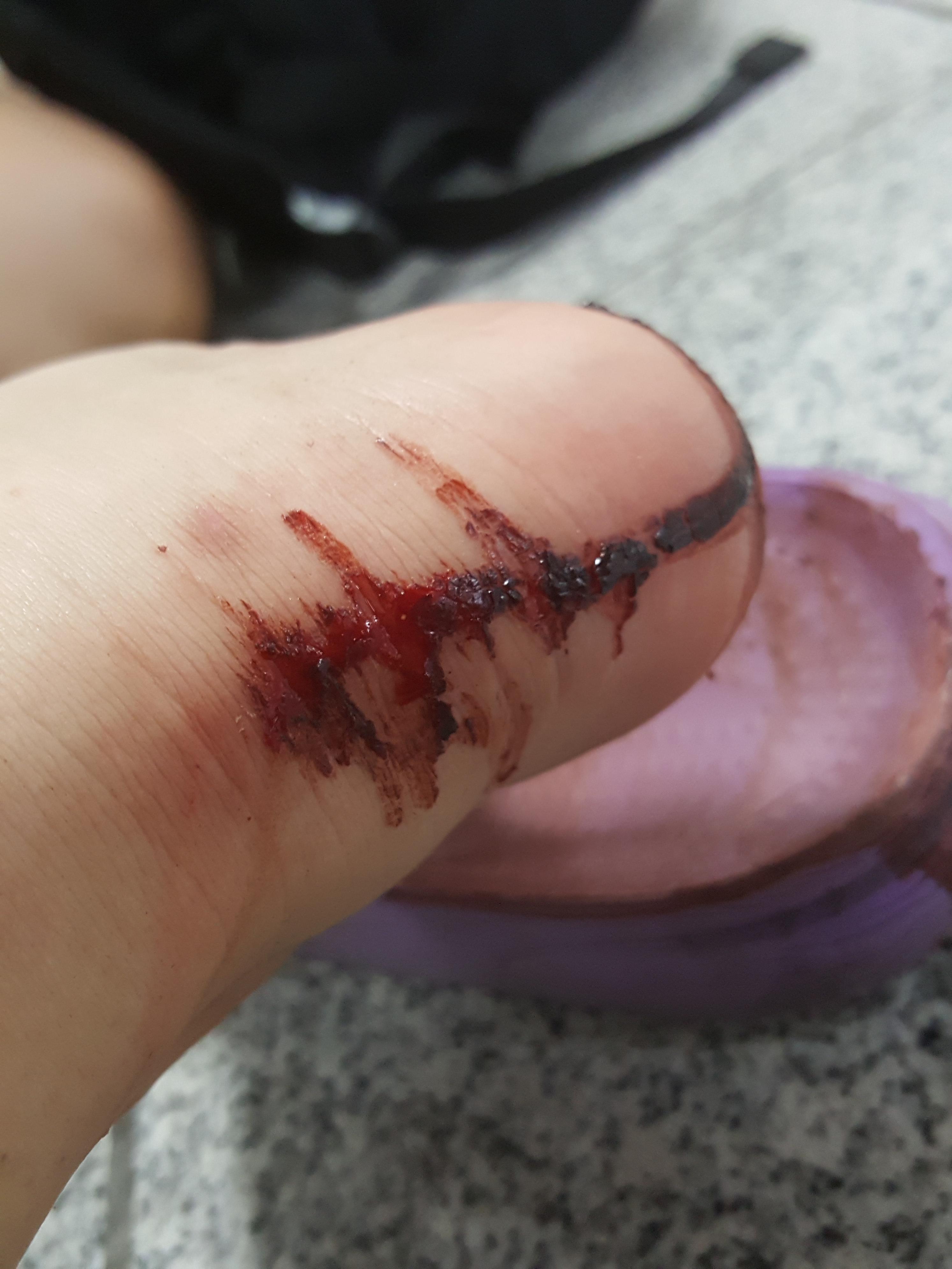 나는 발뒤꿈치에서 피가 이렇게까지 날 수도 있구나~라는 걸 오늘 알았어(ㅎㅇㅈㅇ) | 인스티즈