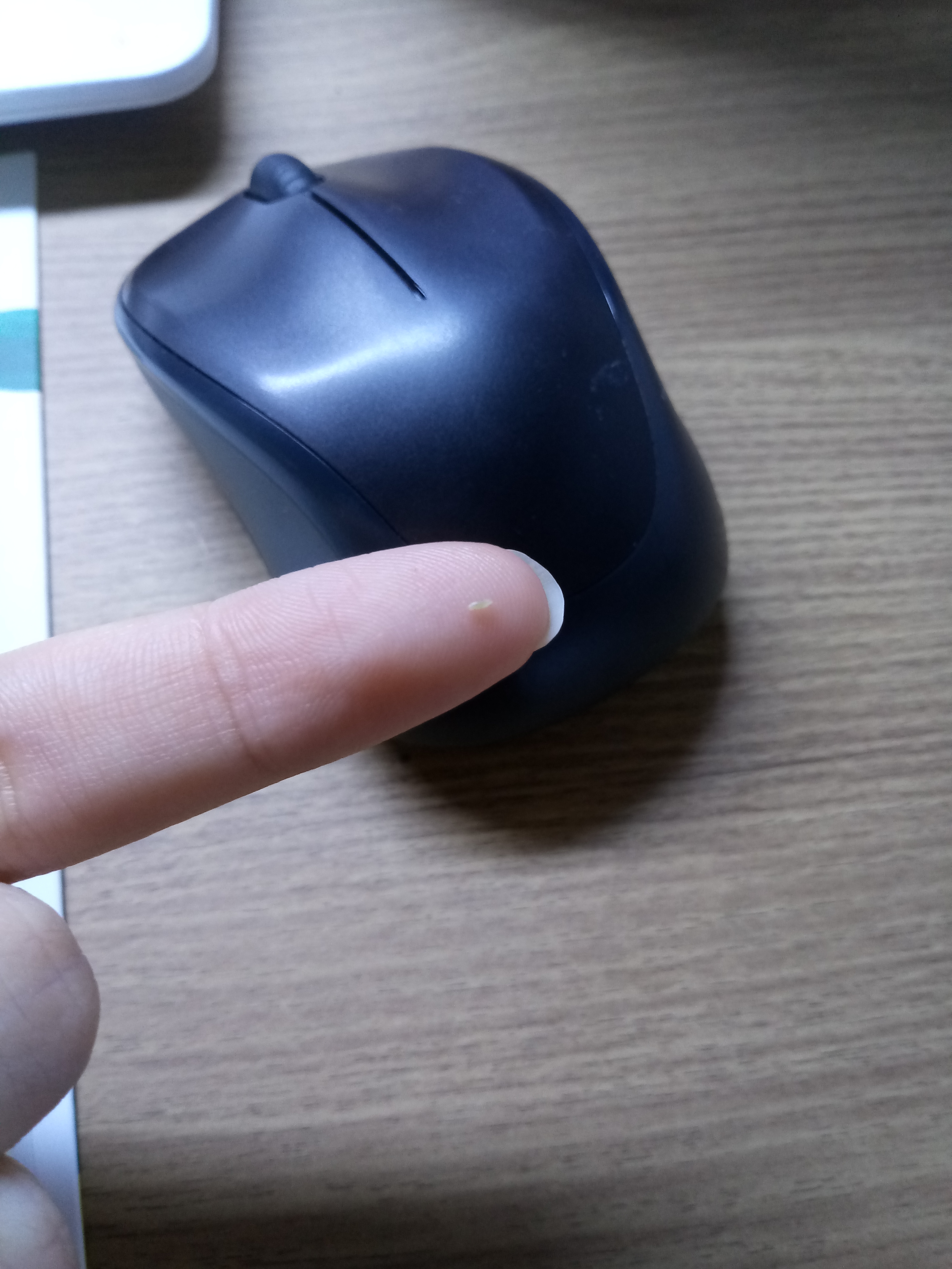 턱에서 피지 뺐다 40 | 인스티즈