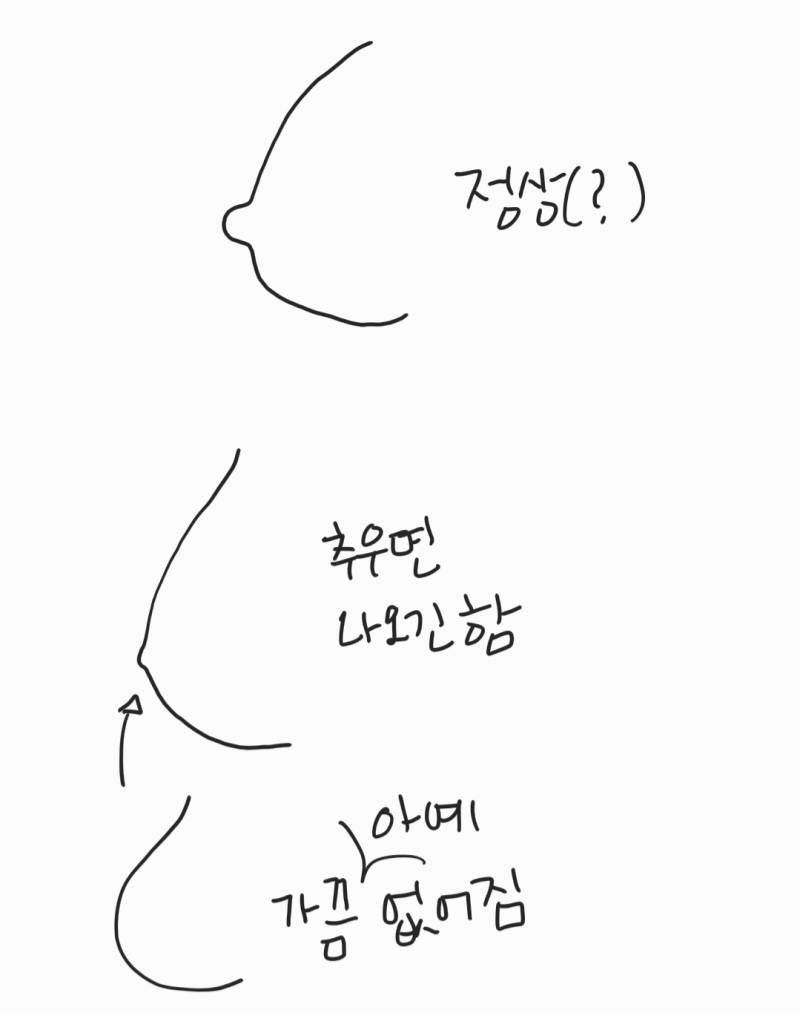 나도 함몰이야?? (ㅎㅂㅈㅇ) 실사아님 | 인스티즈