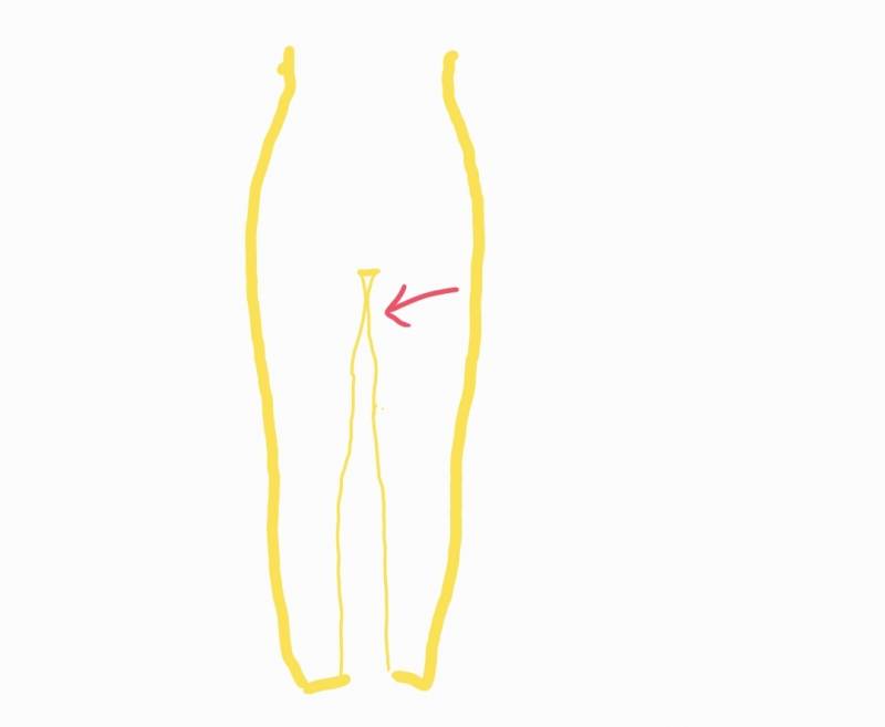 허벅지 안쪽이 이렇게 되어있으면 뭐야? | 인스티즈