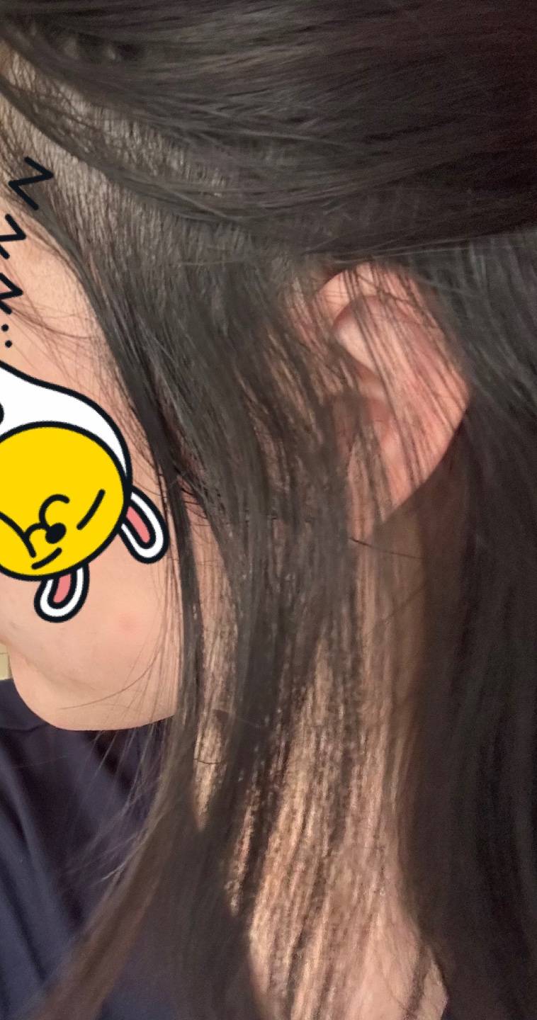 4일전에 매직했는데 머리 이러면 재시술 요구 가능? - 인스티즈(instiz) 익명잡담 카테고리 4일전에 매직했는데 머리 이러면 재시술 요구 가능? - 인스티즈(Instiz) 익명잡담 카테고리
