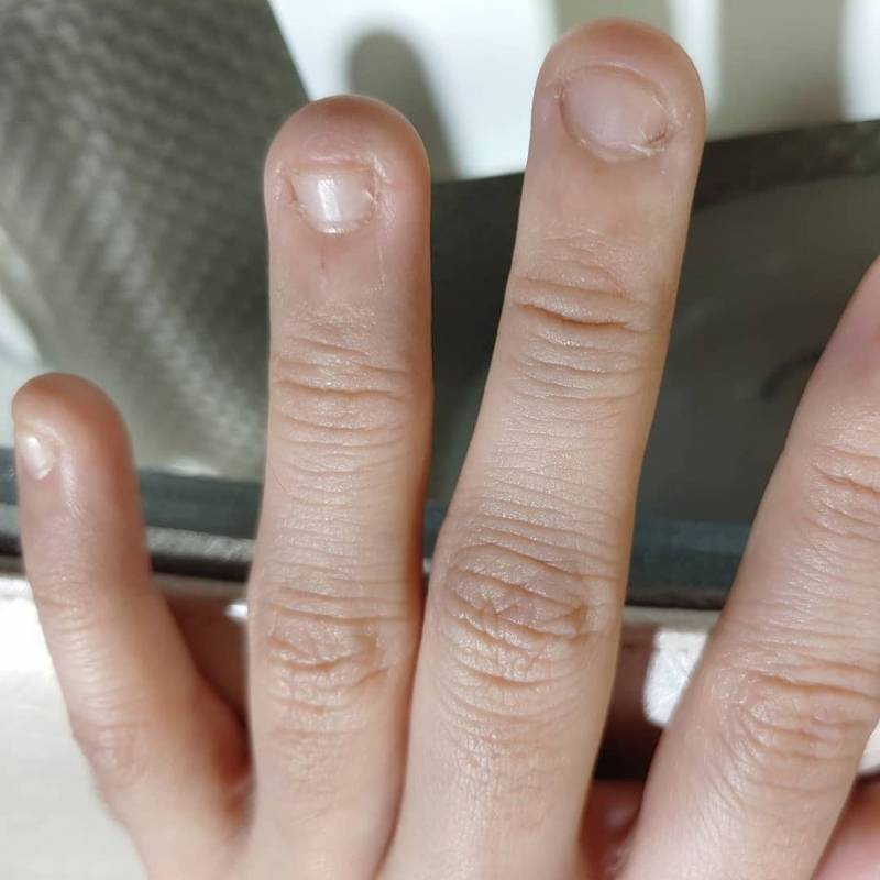 [잡담] 친언니 손톱 어디까지 짧아지나 실험하나봐 - 인스티즈(instiz) 일상 카테고리